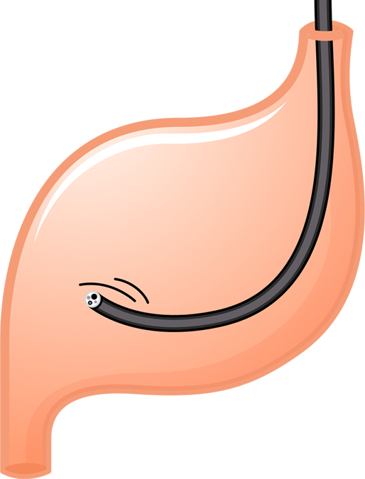 胃袋・カメラ・検査アイコン